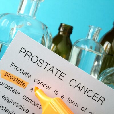 4 Major Risk Factors of Prostate Cancer