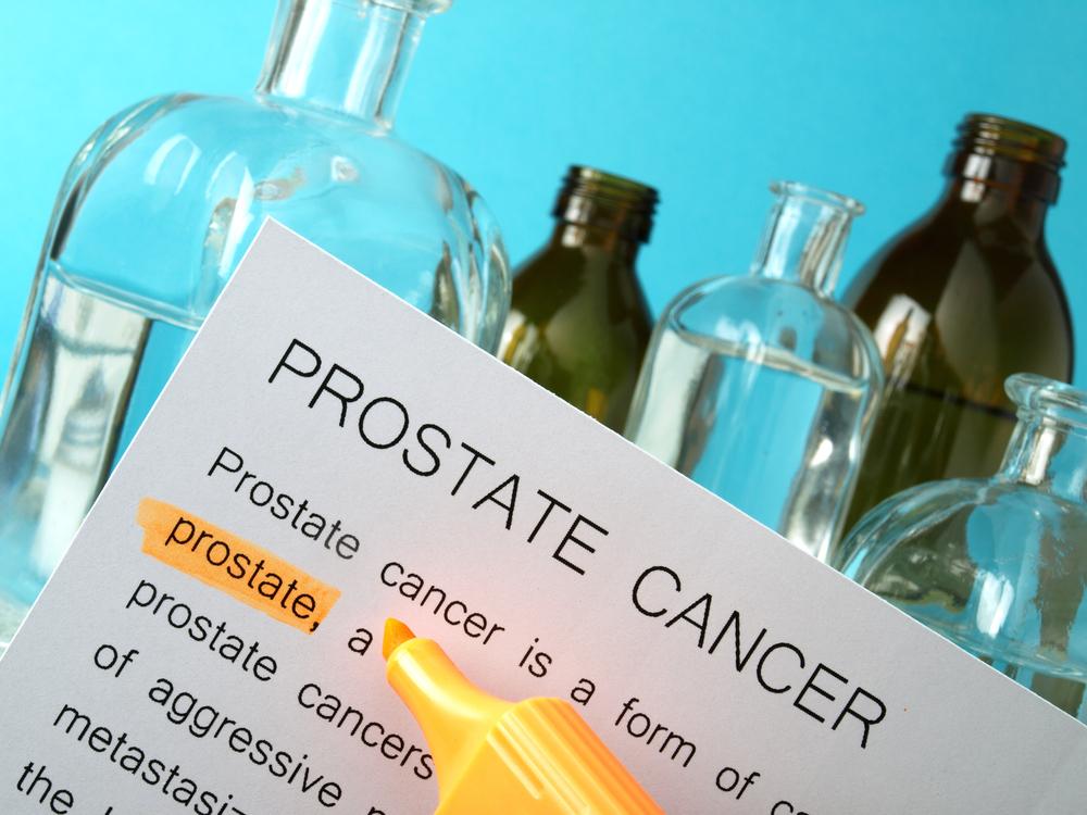 4 Major Risk Factors of Prostate Cancer