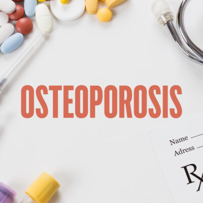 Foods to Avoid When Treating Osteoporosis