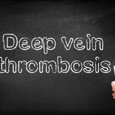 Symptoms and Treatment Measures for Deep Vein Thrombosis