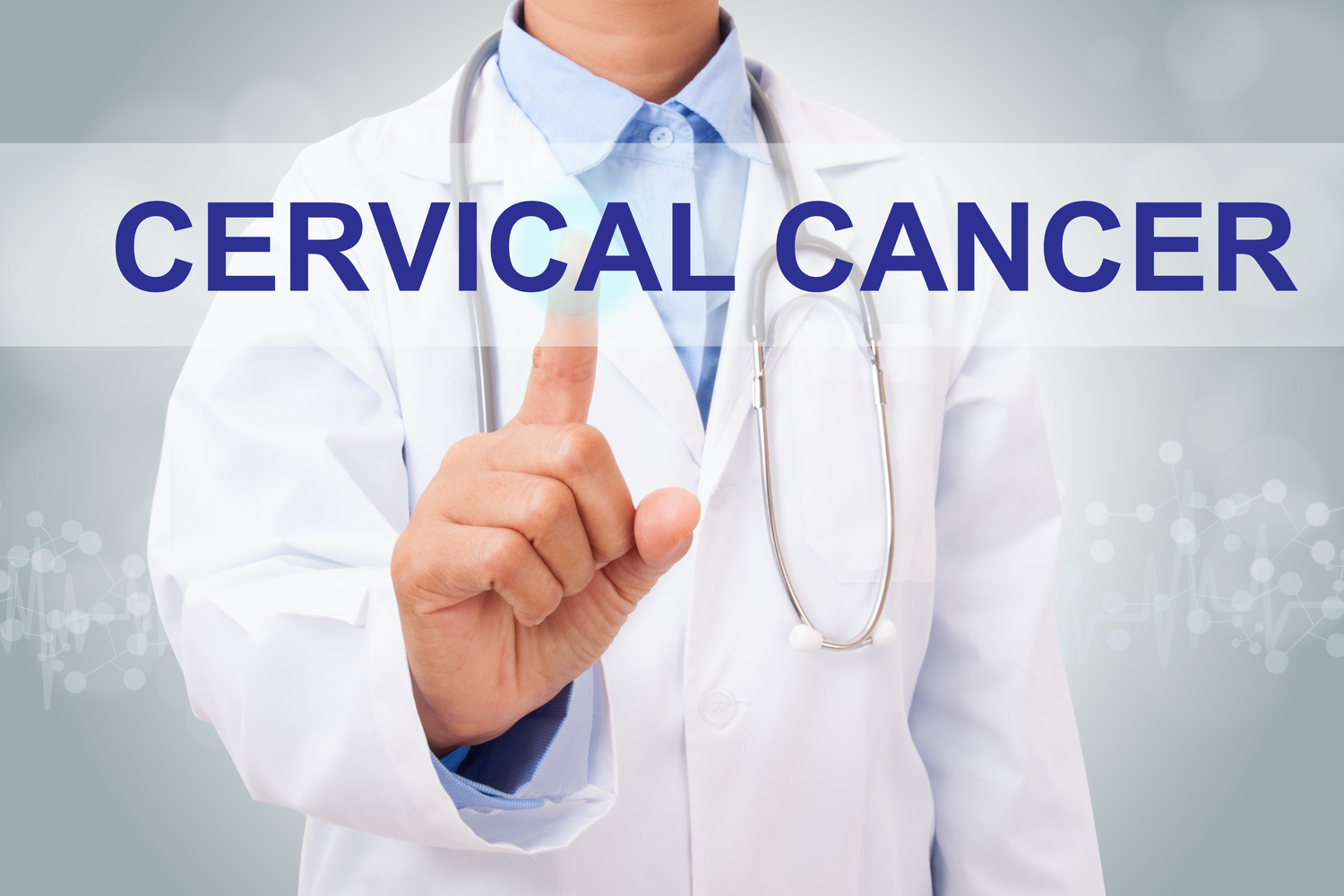 Top 4 Early Warning Signs of Cervical Cancer