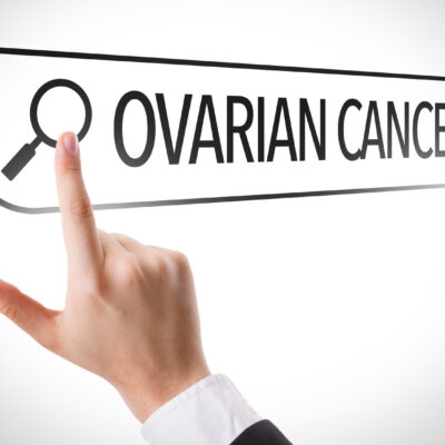 Treatment Options for Invasive Epithelial Ovarian Cancer