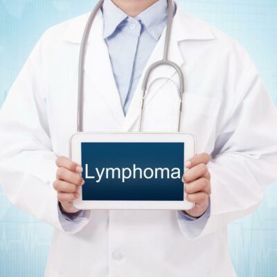 Types of Non-Hodgkin’s Lymphoma