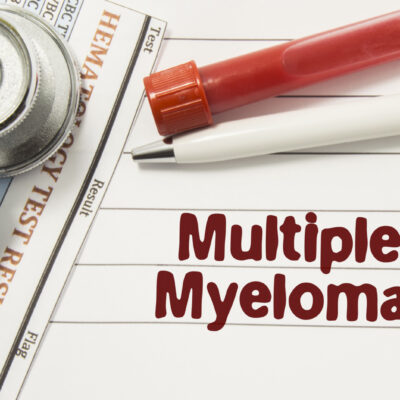 Early Warning Signs of Multiple Myeloma