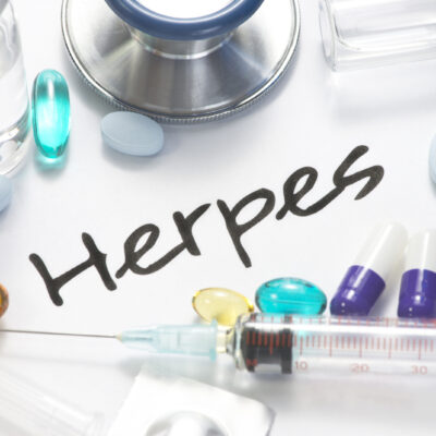 5 Signs and Symptoms of Herpes